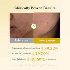 [Subscr.] Kojic Acid Tumeric Toner Pad